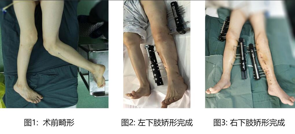 QQ�؈D20230308083607.jpg